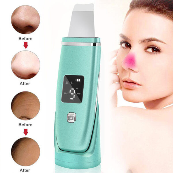 Ultrasonic Vibration Blackhead Remover Deep Cleansing Face Scrubber Pore Cleaner Lifting Machine Facial Led Peeling Shovel - Image 6